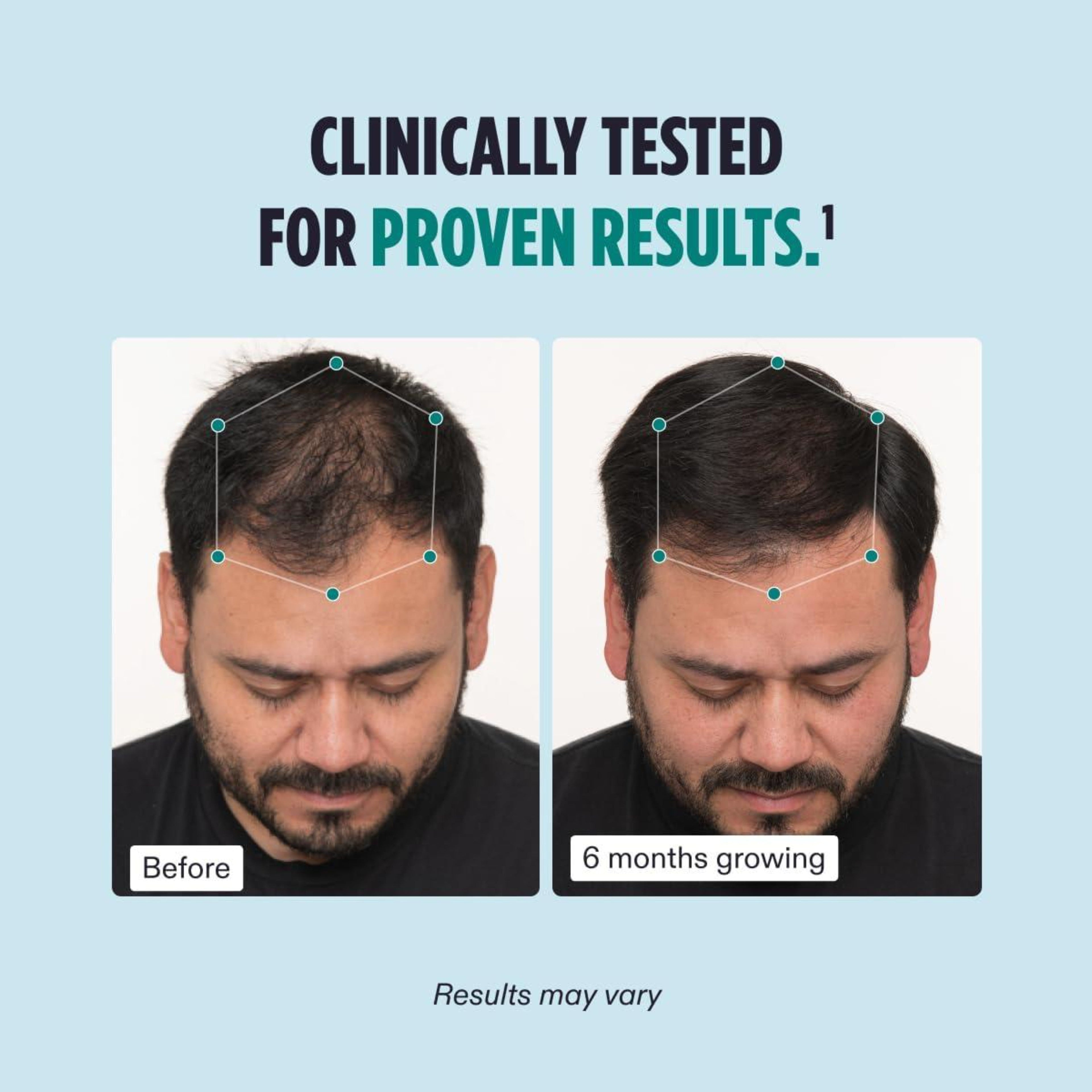 Nutrafol Supplement for Hair Support – 1 Month Supply - Ballimart
